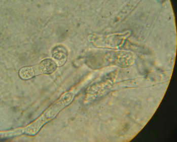 Generation of somatic hybrids of gold-rush